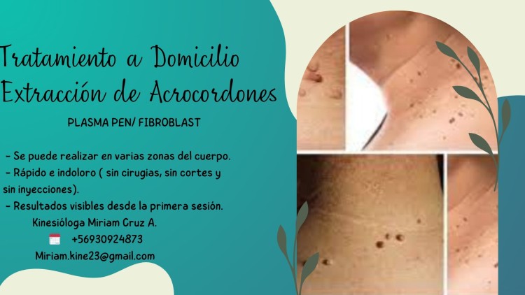 Imagen 4 de servicio