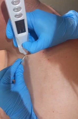 Imagen 3 de servicio