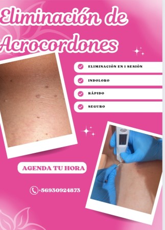 Imagen 5 de servicio