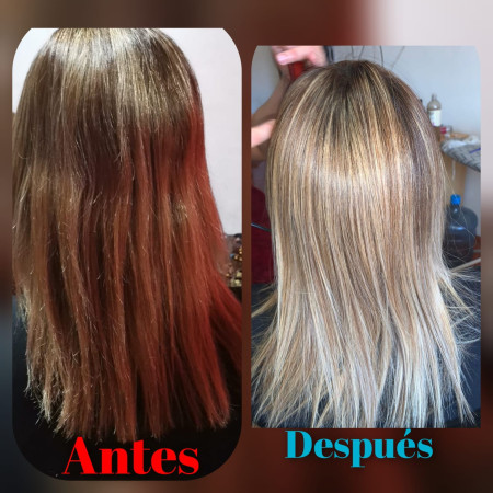 Imagen 5 de servicio