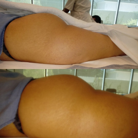 Imagen 8 de servicio