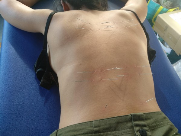 Imagen 3 de servicio