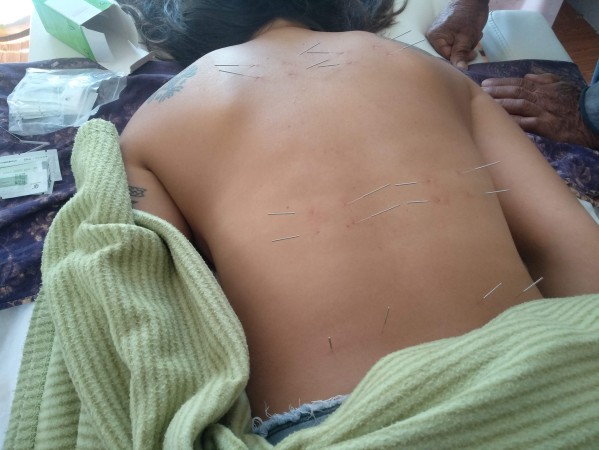Imagen 5 de servicio