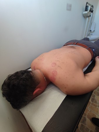 Imagen 8 de servicio