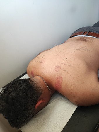 Imagen 9 de servicio