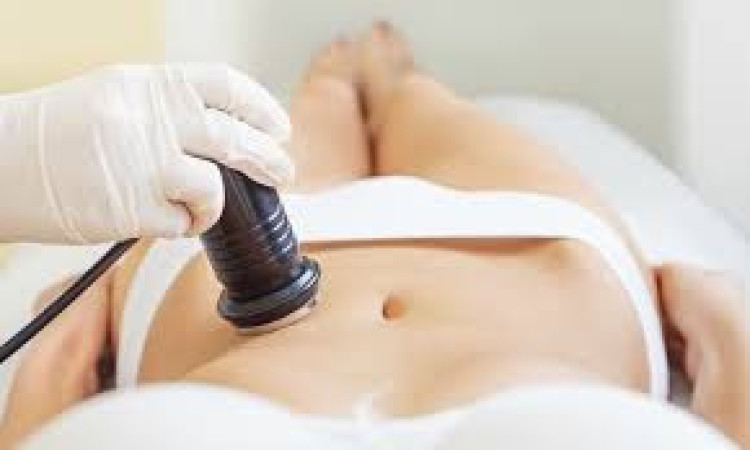 Imagen 4 de servicio