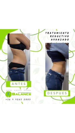 Imagen 20 de servicio