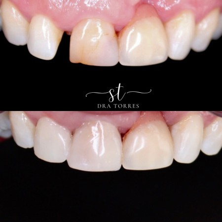 Imagen 4 de servicio