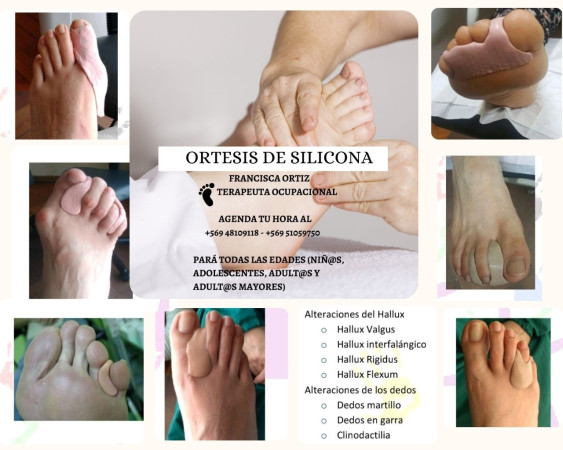 Imagen 17 de servicio