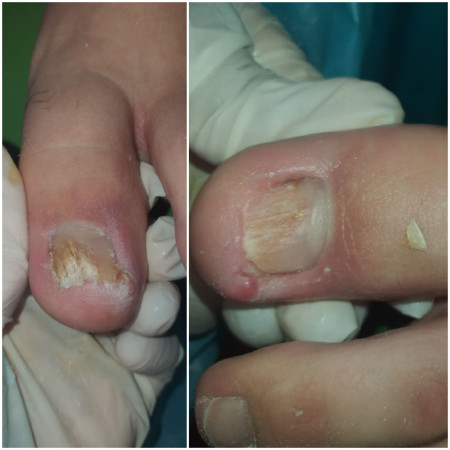 Imagen 4 de servicio