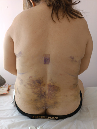 Imagen 2