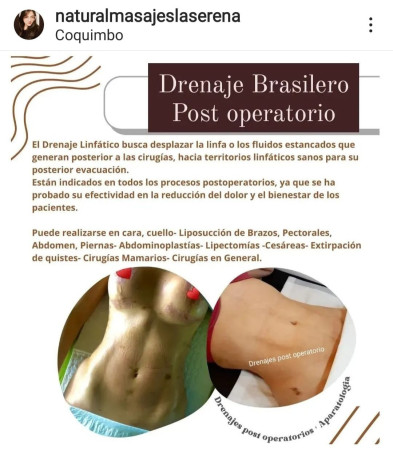 Imagen 4 de servicio
