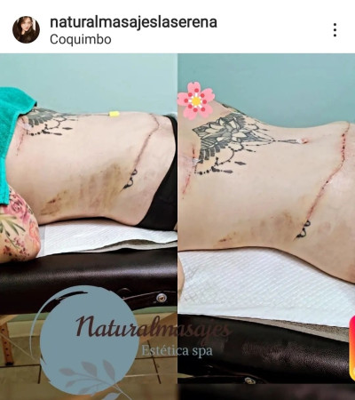 Imagen 6 de servicio