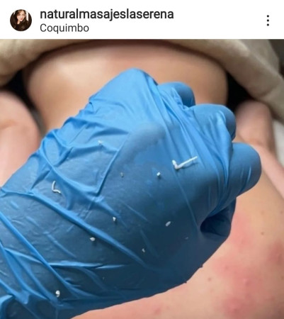 Imagen 7 de servicio