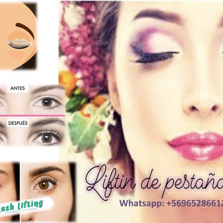 Imagen 4 de servicio