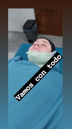 Imagen 3 de servicio