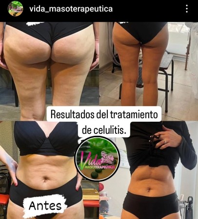 Imagen 0