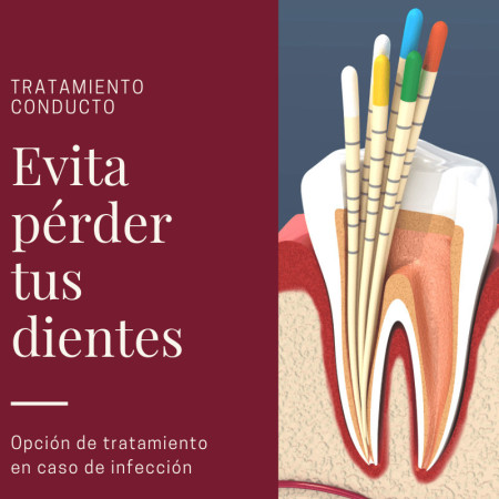 Imagen 4 de servicio