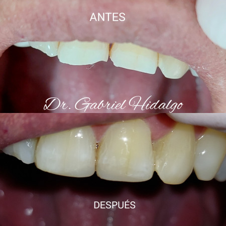Imagen 1