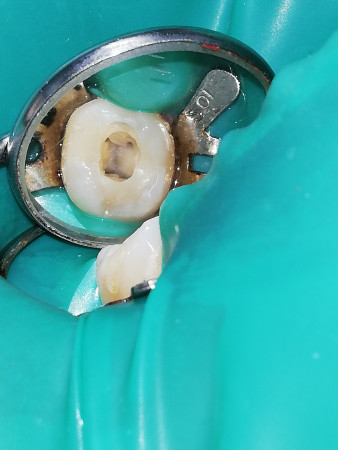 Imagen 5 de servicio