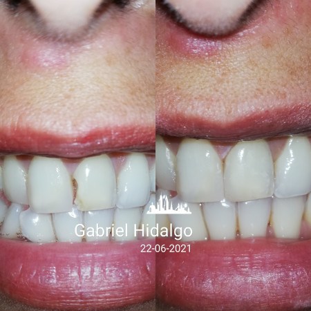 Imagen 6 de servicio
