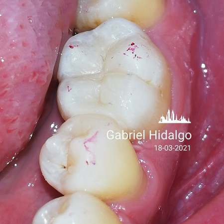 Imagen 7 de servicio