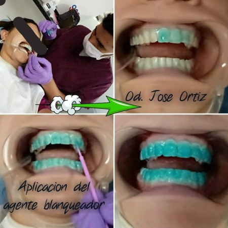 Imagen 1