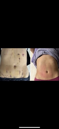 Imagen 5 de servicio