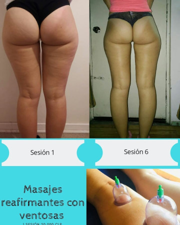 Imagen 3 de servicio