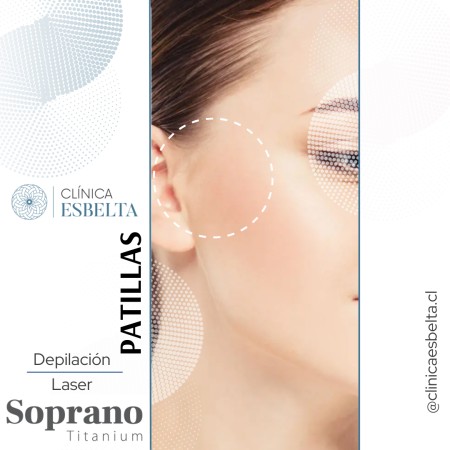 Imagen 23 de servicio