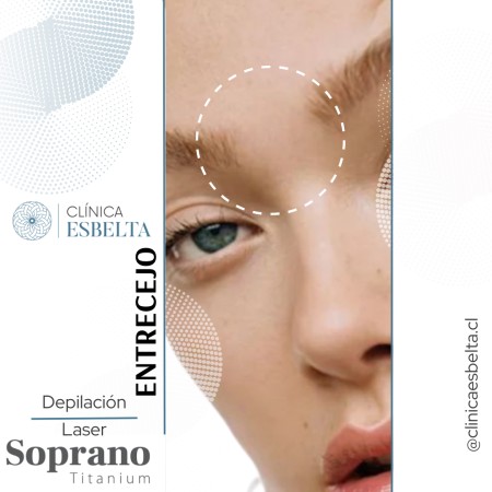 Imagen 24 de servicio