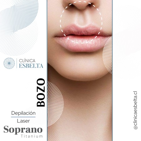 Imagen 30 de servicio