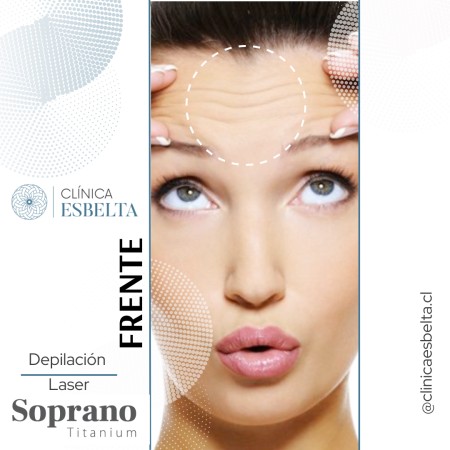 Imagen 31 de servicio