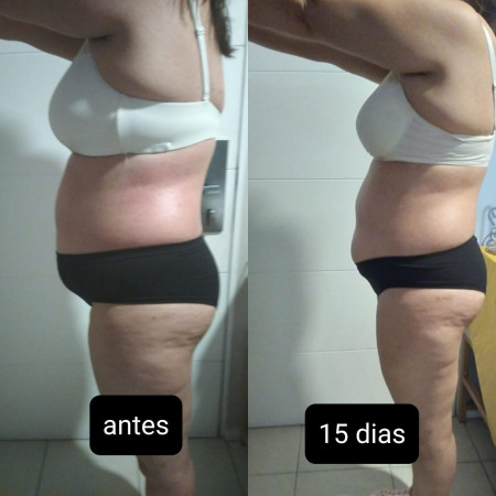 Imagen 10 de servicio