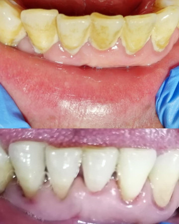 Imagen 3 de servicio