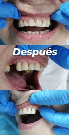 Imagen 5 de servicio