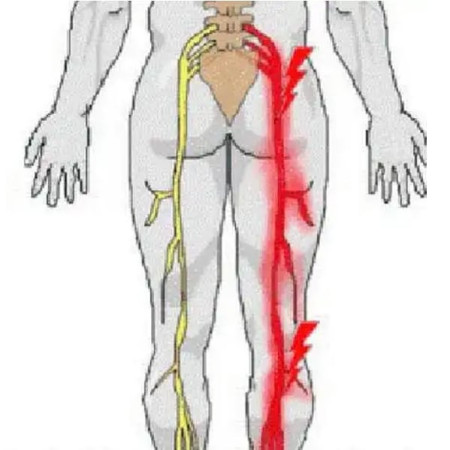 Imagen 5 de servicio