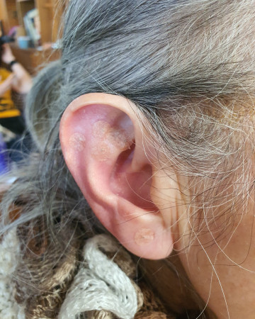 Imagen 2