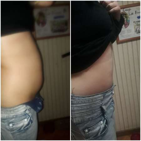 Imagen 4 de servicio