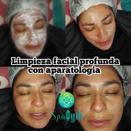 Imagen 3 de servicio