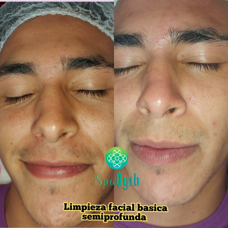 Imagen 4 de servicio