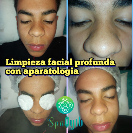 Imagen 7 de servicio