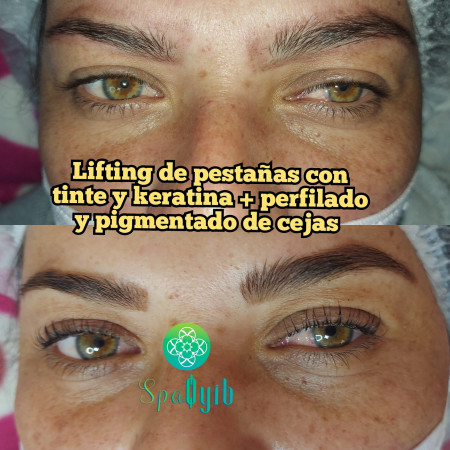 Imagen 8 de servicio