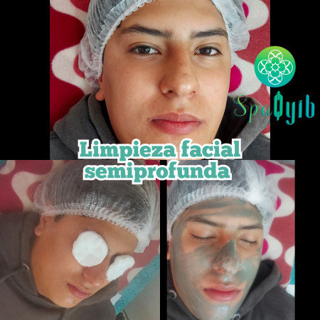 Imagen 13 de servicio