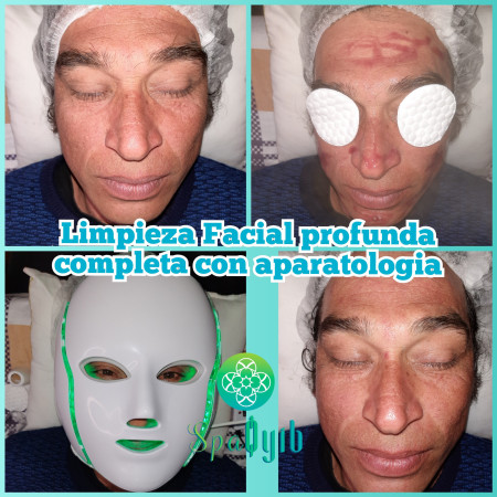 Imagen 14 de servicio