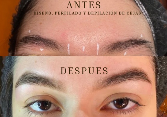 Imagen 0