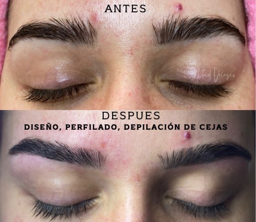 Imagen 14 de servicio