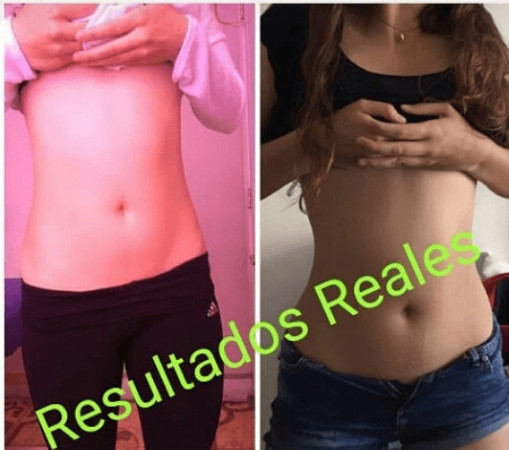 Imagen 3 de servicio