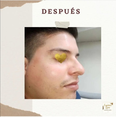 Imagen 6 de servicio