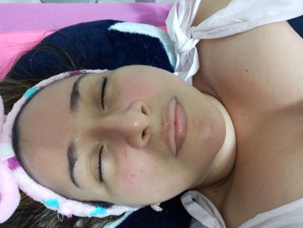 Imagen 8 de servicio